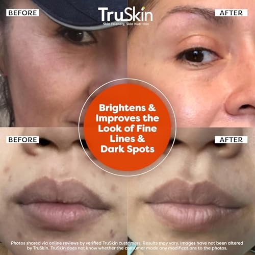 TruSkin Vitamin C Serum - Anti Aging Brightening Serum for Face, Dark Spots, Fine Lines & Wrinkles