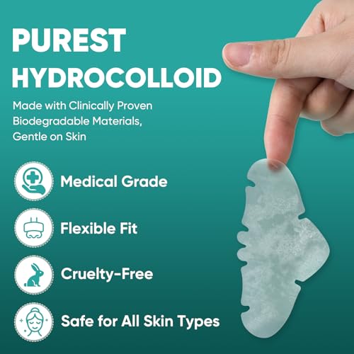 Hydrocolloid Nose Pore Strips - 30 Count, Overnight Oil-Absorbing, Pimple Stickers for Acne Gunk